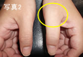 手の痛み 千葉県市川市の照沼整骨院 肩こり 腰痛 スポーツ障害 フィットネス インソールならお任せください