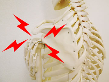 肩の怪我の主な原因